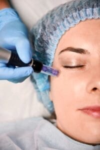 Microneedling Behandlung Kosmetikstudio Bottrop Schönheitssalon Vraie Beauté