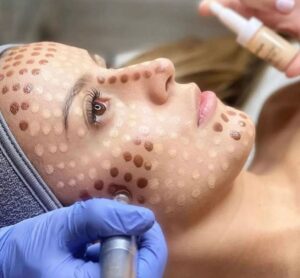 BB Glow Behandlung Kosmetikstudio Bottrop Schönheitssalon Vraie Beauté