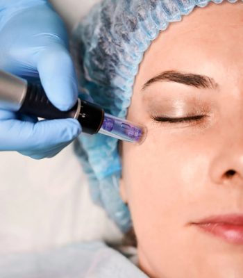 Microneedling Behandlung Kosmetikstudio Bottrop Schönheitssalon Vraie Beauté
